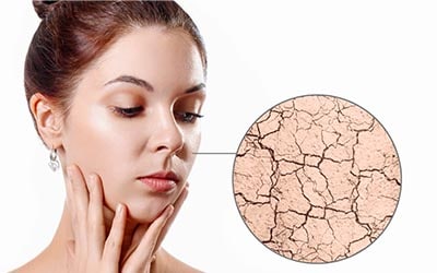 Dry Skin face